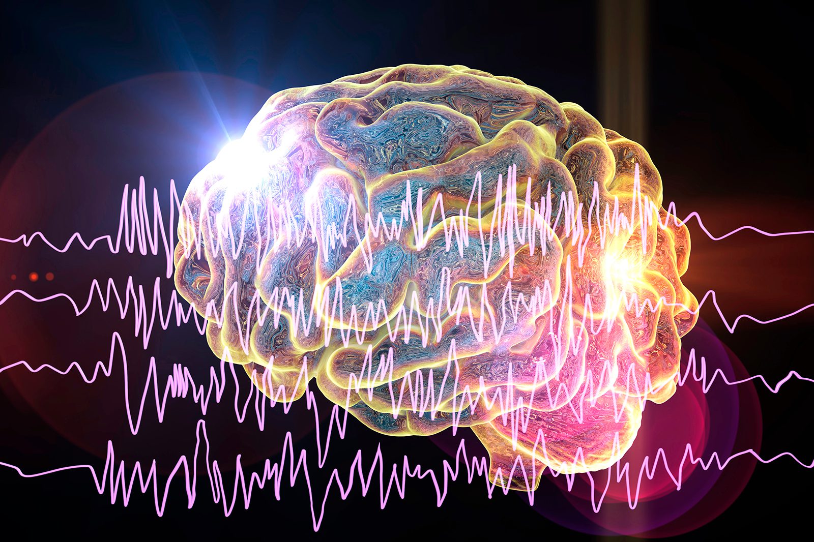 Epilepsias genéticas